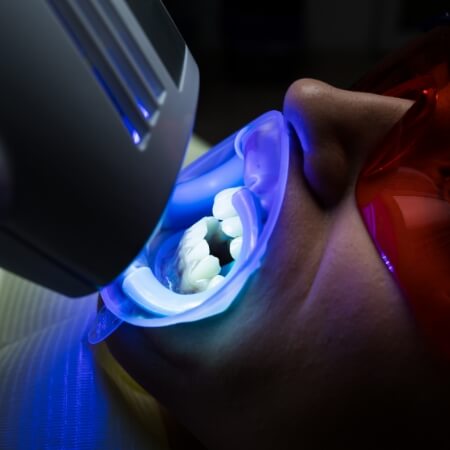 Dental patient receiving teeth whitening treatment