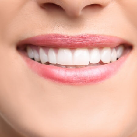 Closeup of healthy smile after dental bonding
