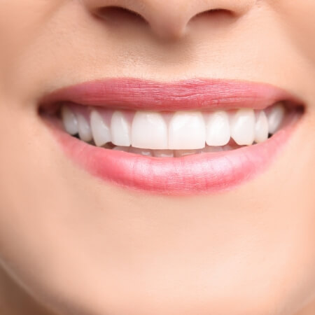 Closeup of healthy smile