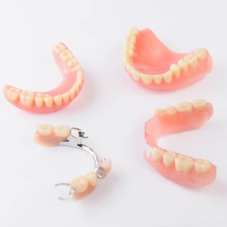 Four types of dentures