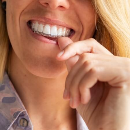 Dental patient placing an Invisalign tray