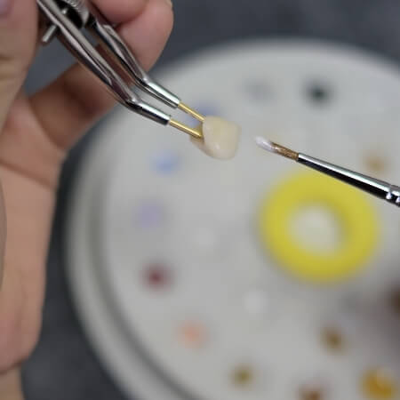 Dental team member crafting a dental crown