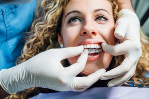Woman having Invisalign placed by her dentist