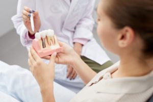 a dentist explaining dental implants to a patient